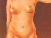 lipo1